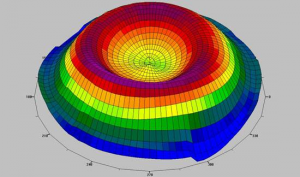 Imatge seguiment i tractament dels Queratoconus